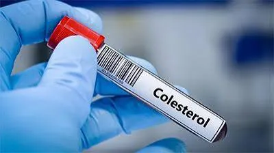 Pesquisa controla colesterol alto por até um ano com dose única de edição genética