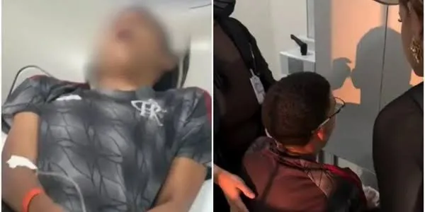 Bocejo pode deslocar mandíbula? Caso de jovem viraliza e especialista explica o risco