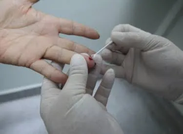 Jacareí intensifica testagem gratuita para HIV, sífilis e hepatites B e C com campanha Fique Sabendo 2026