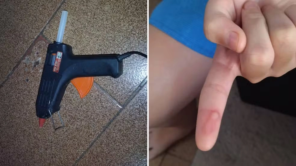 Alunos teriam sido queimados com cola quente em escola de Birigui; professora é investigada