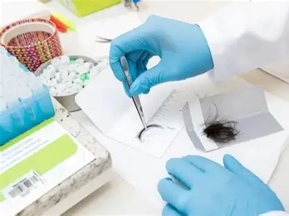 Exame toxicológico para CNH: entenda como a coleta deve ser feita e por que caso na Paraíba foge do protocolo