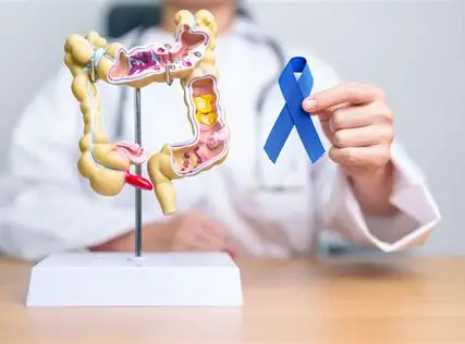Diagnóstico precoce pode curar mais de 90% dos casos de câncer de intestino, alertam especialistas