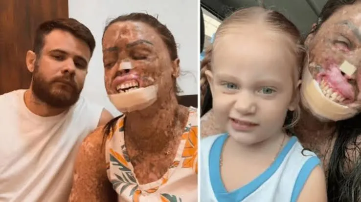 Influenciadora Kah Felipe morre após complicações provocadas por doença rara e metástase