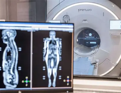 Exame que vasculha o corpo inteiro promete detectar sinais de doenças antes dos sintomas e atrai fila de 100 mil pessoas